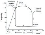 Rys. 9. Pętla pracy serca na płaszczyźnie ciśnienie-objętość na przykładzie lewej komory serca (a – napełnianie, b – skurcz izowolumertyczny c – wyrzut, d – rozkurcz izowolumertyczny) [Left ventricle pressure-volume plane ( a – filling, b – isovolumetric contraction, c – ejection, d – isovolumetric relaxation)]