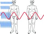 Rys. 5. Wnikanie fal elektromagnetycznych o różnej długości (częstotliwości) w ciało człowieka [Electromagnetic waves of various lengths (frequencies) penetrating the human body]
