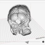 Symulacje zabiegów, modele chorych narządów, czyli jak druk 3D staje się ważnym asystentem lekarzy. Fot. PrintMed 3d